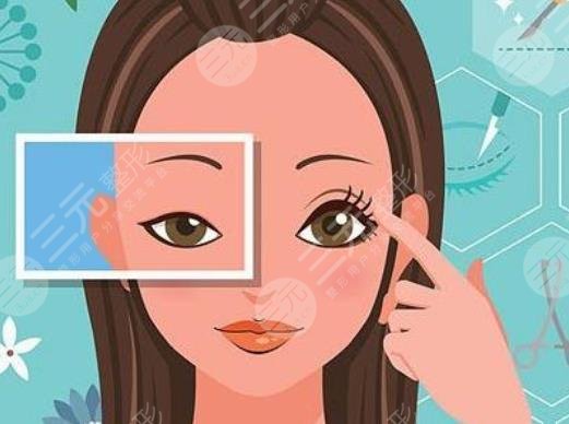 女子割雙眼皮!當(dāng)場喪命