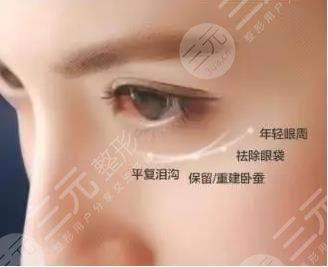 超聲波去眼袋優(yōu)勢(shì)