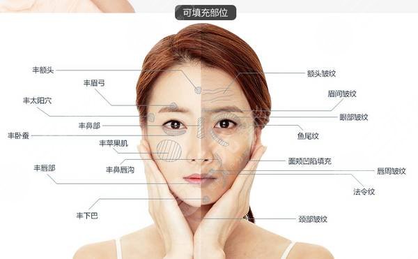 額頭填充手術(shù)術(shù)前要準備哪些工作?