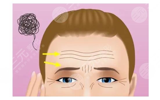 額頭填充手術(shù)術(shù)后如何護理?