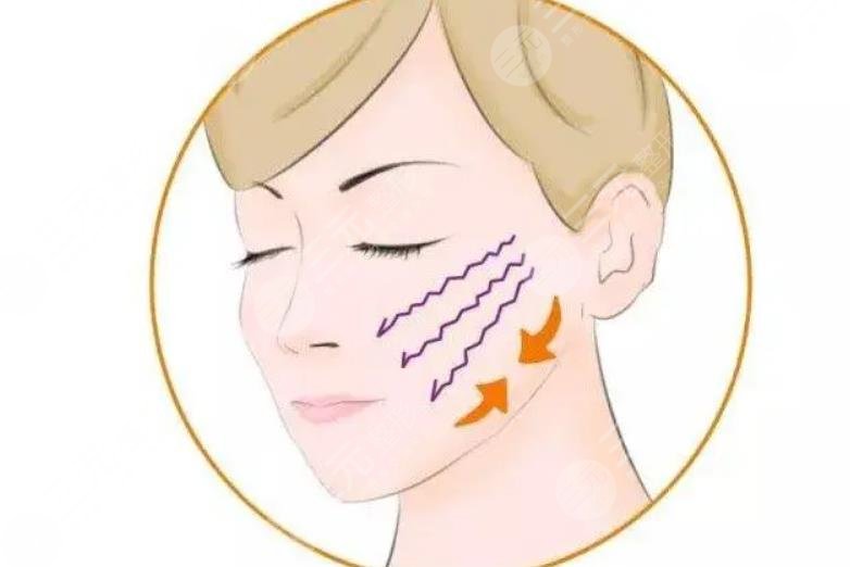 面部拉皮大概需要多少錢