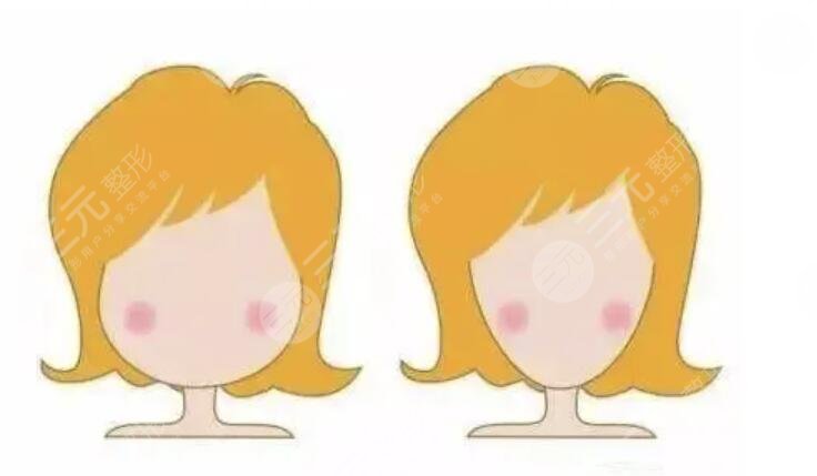 進(jìn)行下顎骨手術(shù)的注意事項(xiàng)