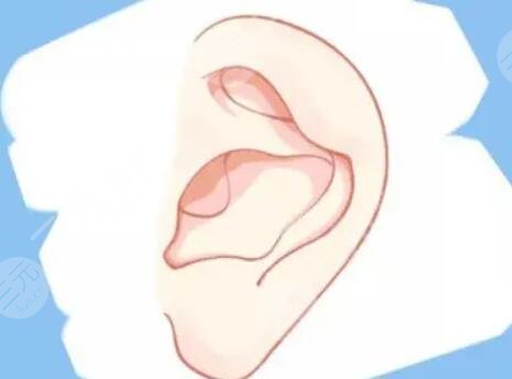 杯狀耳整形