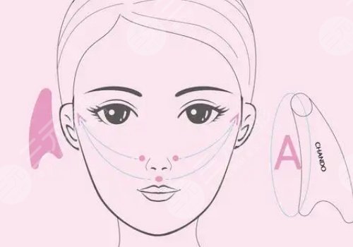 v-line瓜子臉手術(shù)注意事項(xiàng)