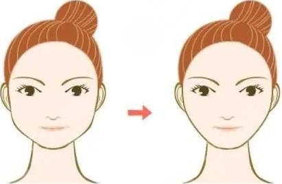 做改臉型術要多少錢