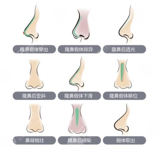 北京伊美爾何禎平醫(yī)生擅長項目科普