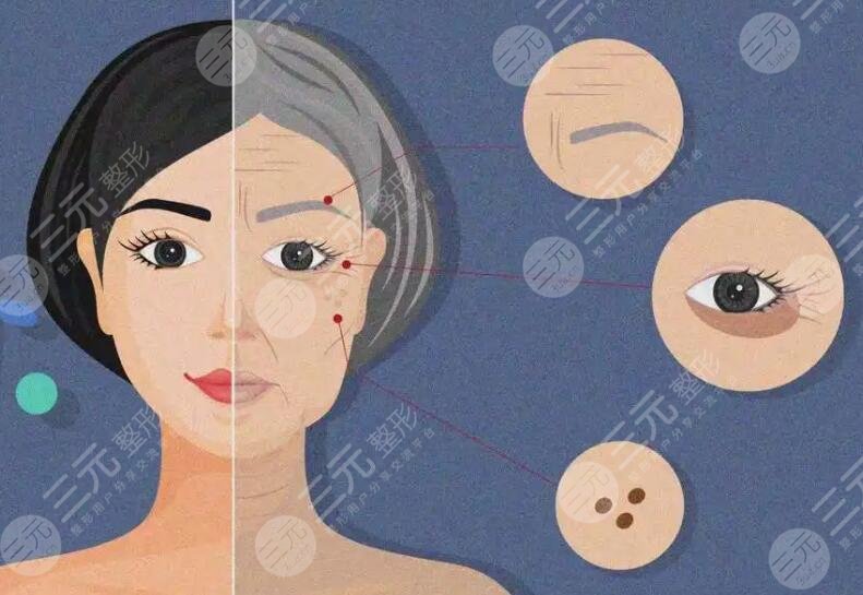 冰電波拉皮多少錢一次