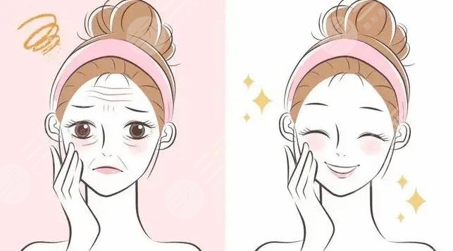 盧建建面部微調(diào)怎么樣