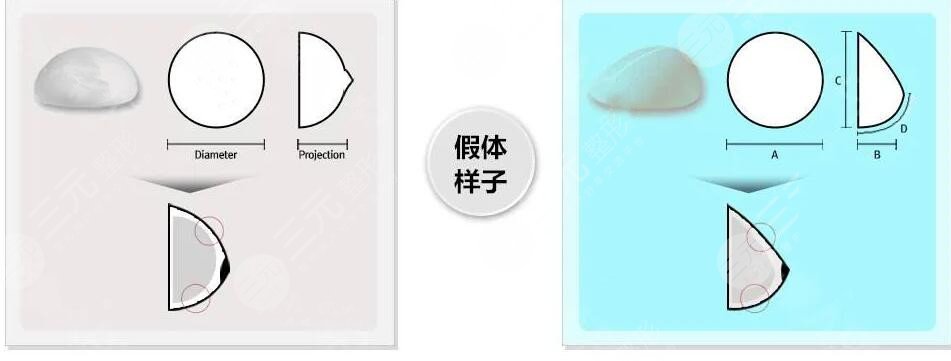 進(jìn)口曼托隆胸多少價格