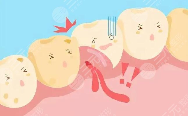 健康牙齦的顏色是什么顏色的？白色更健康是真的嗎？事實(shí)會(huì)突破你的認(rèn)知~