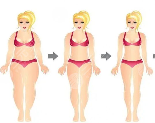 宜昌中心醫(yī)院抽脂案例分享: