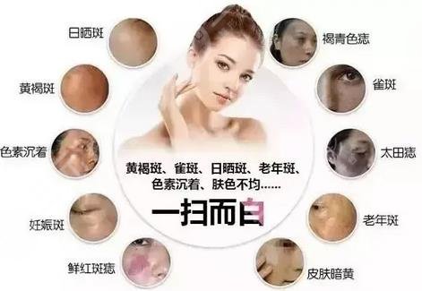 廣州人民醫(yī)院美容科祛斑貴嗎