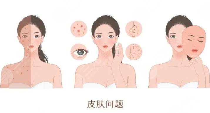 珠海人民醫(yī)院祛斑案例分享