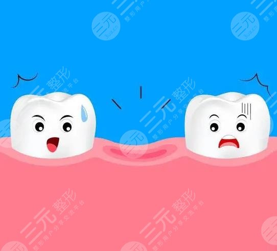 泰安中心醫(yī)院種植牙案例