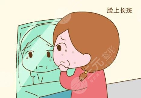 激光祛斑20天變化圖片