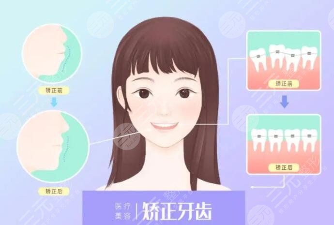 牙齒矯正年齡限制在多少歲？幾歲是正畸的黃金年齡？來看看你處在哪個年齡段！