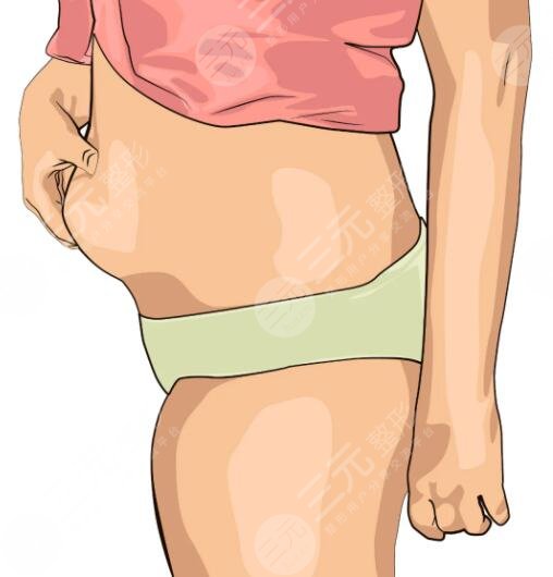 腹部吸脂減肥手術后要注意的問題