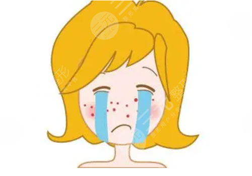 e光祛痘多少錢一次？