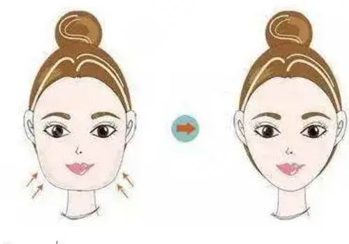 怎么減小咬肌大小?