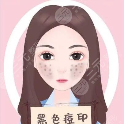 杭州浙二院緩解痘痘案例分享