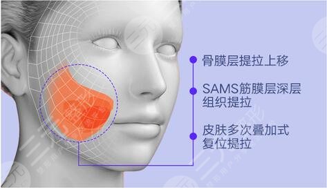 顴骨高適合中分嗎？