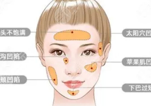 自體脂肪豐蘋(píng)果肌果好嗎?