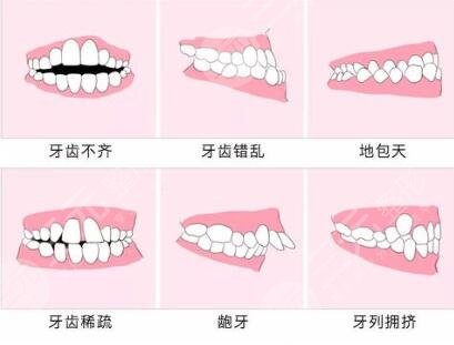 梅州人民醫(yī)院熱門項(xiàng)目