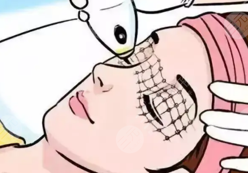 去魚(yú)尾紋方法有哪些?