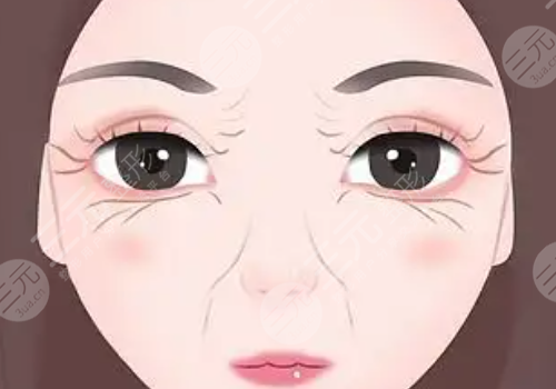 去魚(yú)尾紋方法有哪些?