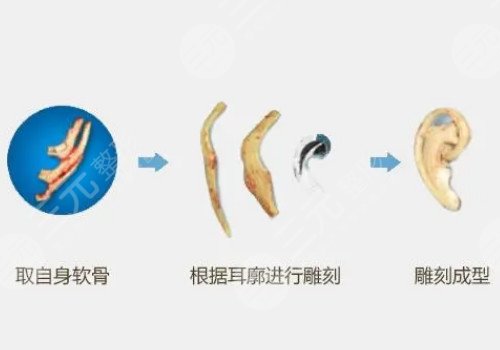 郭樹(shù)忠醫(yī)生擅長(zhǎng)項(xiàng)目介紹