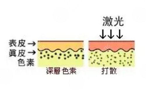 快速變白的方法有哪些?
