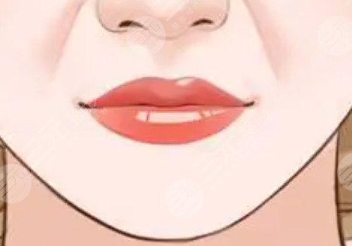 厚嘴唇怎么變薄？