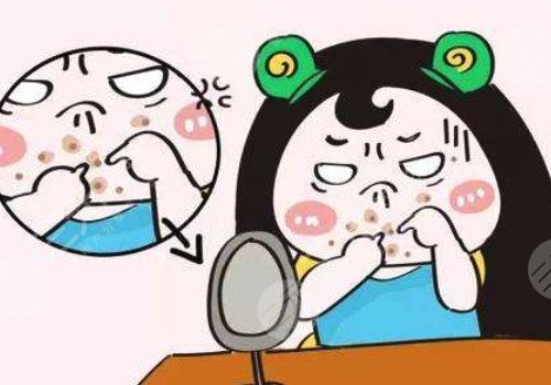 臉上長(zhǎng)痘印如何消除?