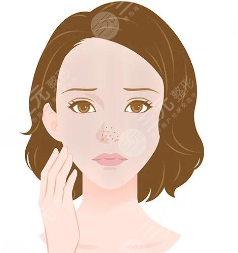 如何收縮鼻頭毛孔小妙招！這幾個有方法看完就會了！處理不當(dāng)會更糟糕！