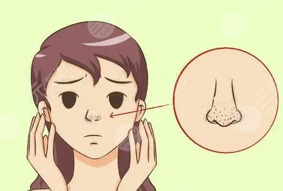鼻頭毛孔粗大是由于哪些方面導(dǎo)致的?