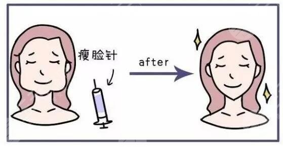 咬肌大怎么辦怎么改良快速又有？怎么判斷自己咬肌是否過大？