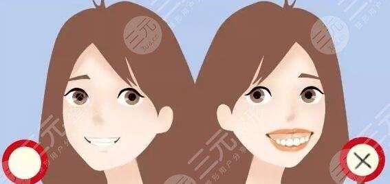 東莞人民醫(yī)院正畸價格