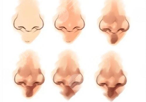 重慶軍科醫(yī)院林勇做鼻子怎么樣?