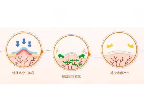 如何祛除臉上的疤痕?