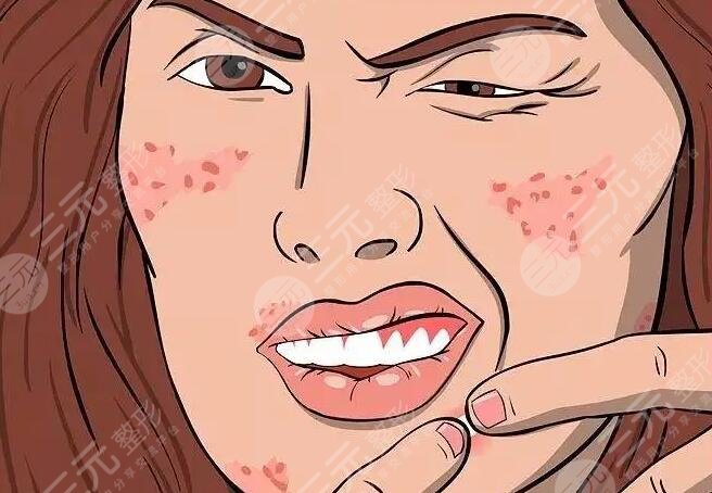 怎樣消除紅腫的痘痘更有？這幾種方法好用又操作簡(jiǎn)單！果是肉眼可見的！