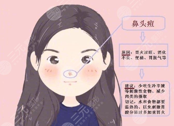 鼻子上長(zhǎng)痘痘是什么原因引起的?