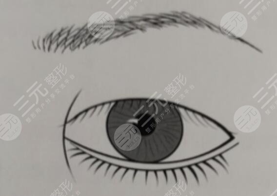 做開眼角手術(shù)要注意什么?