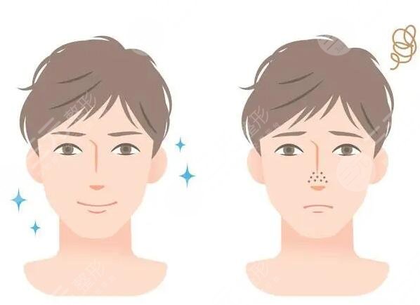 男性油性皮膚怎么改良?