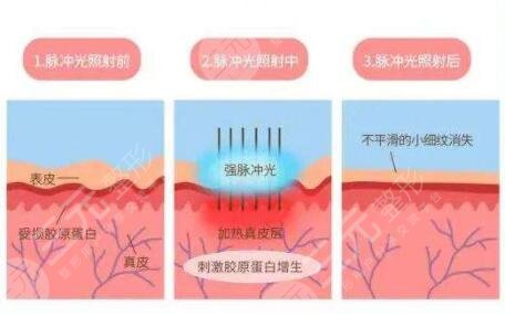 皮膚美容的技術手段有哪些?