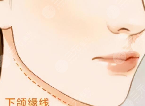 下頜角肥大矯正術(shù)術(shù)后并發(fā)癥有哪些？手術(shù)風(fēng)險和注意事項(xiàng)才應(yīng)該是關(guān)注重點(diǎn)！