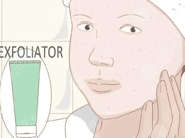 面部去角質(zhì)產(chǎn)品哪個(gè)好?