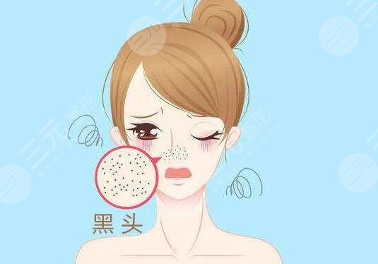 蘇打水去黑頭對皮膚有損害嗎?