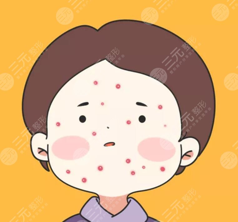 相宜本草祛痘凝膠的案例介紹