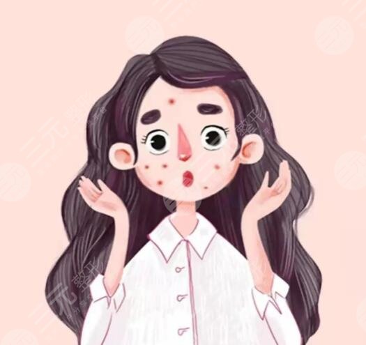 復(fù)合彩光去痘幾次有？復(fù)合彩光去痘的原理和果解析，網(wǎng)友打卡后反饋~