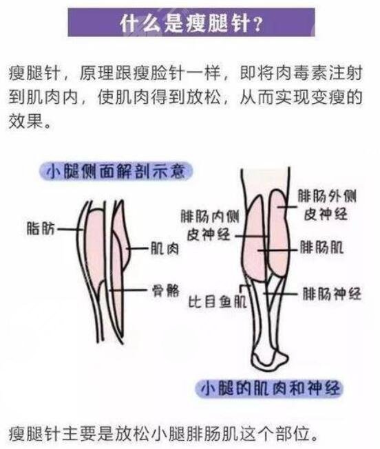 肌肉小腿怎么瘦成筷子腿肚子？